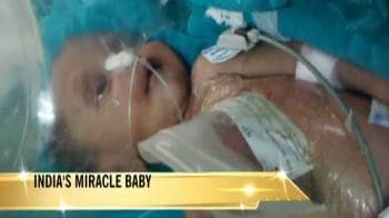 Video : India's miracle baby recovers in hospital
