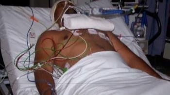 2 more race attacks in Australia