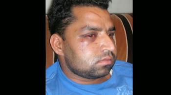 3 Indians attacked by mob of 80 in Australia