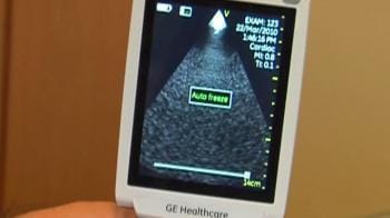 Video : World's smallest portable ultrasound machine